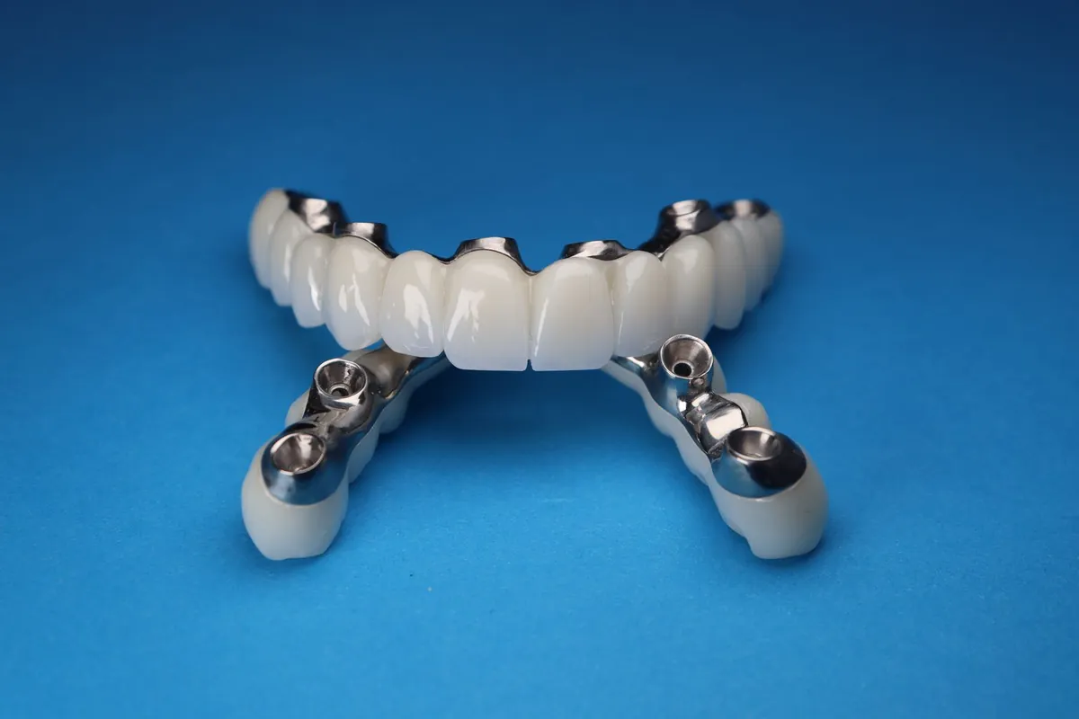 Prótesis sobre implantes